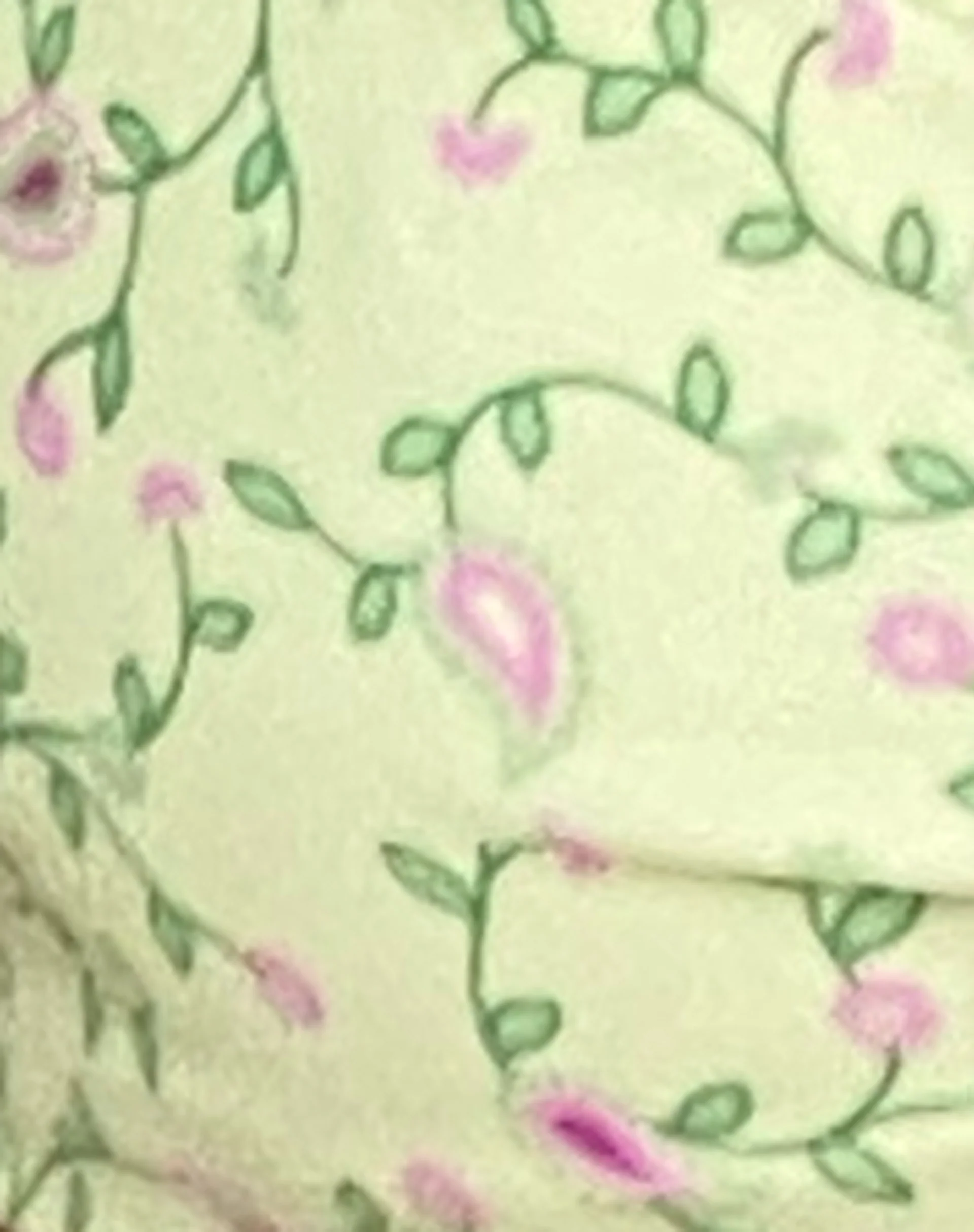 Laufey Bikini Top in Paisley Fun Yellow - Image 7